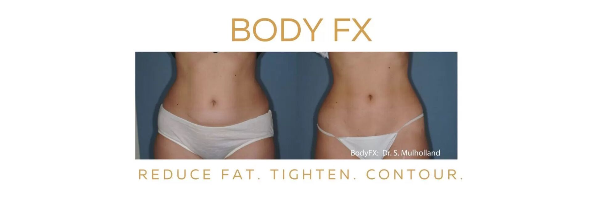 Body FX richmond bc before and after