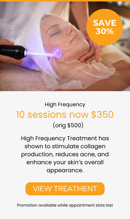high frequency package