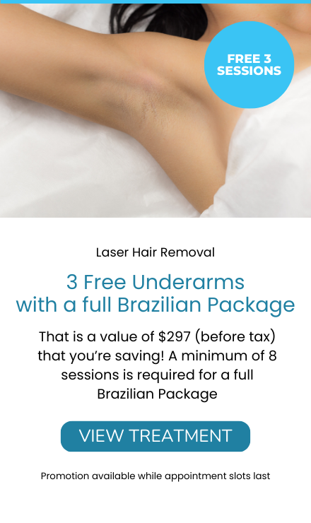 Laser Hair Removal Promotion