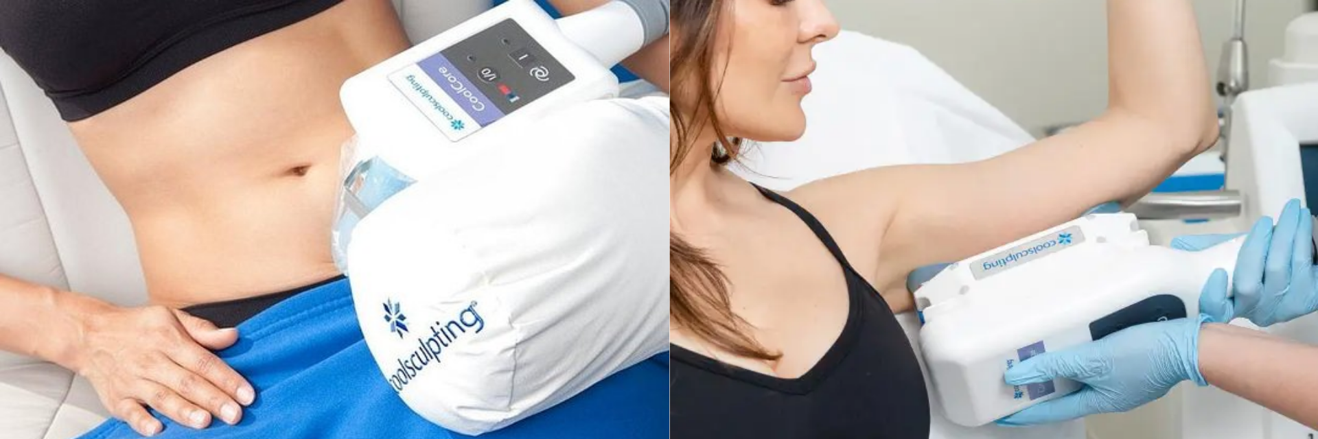 CoolSculpting Richmond BC