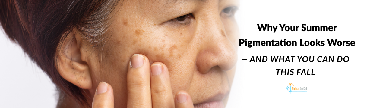 Summer pigmentation and fall skin treatment for sun-exposed skin